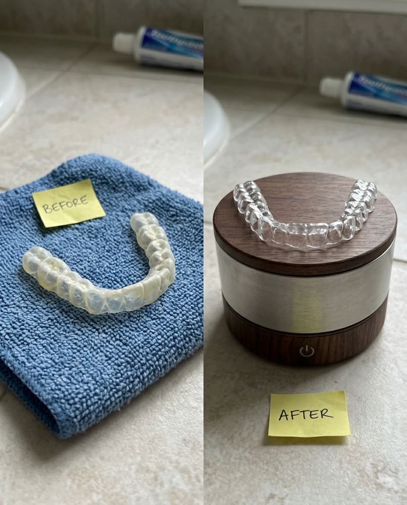 Before and after: a cloudy chalky retainer on a blue washcloth on the left, and a crystal-clear retainer resting on the Ultrapod's walnut lid on the right